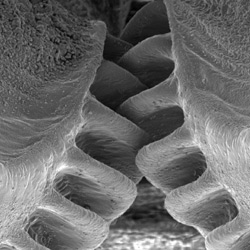 Gear-like structures on legs of plant hopper insects.