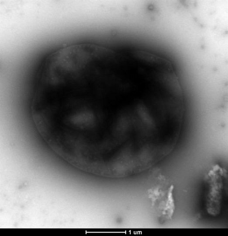 Transmission electron microscopy image of engineered M. acetivorans strain capturing methane. Thomas Wood, Penn State