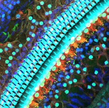 A view of a small part of the mammalian cochlea, which features rows of sensory hair cells (cyan) and synaptic sites (small green and yellow dots), where the sensory hair cells communicate to the nerves. (Juemei Wang/Oghalai lab)