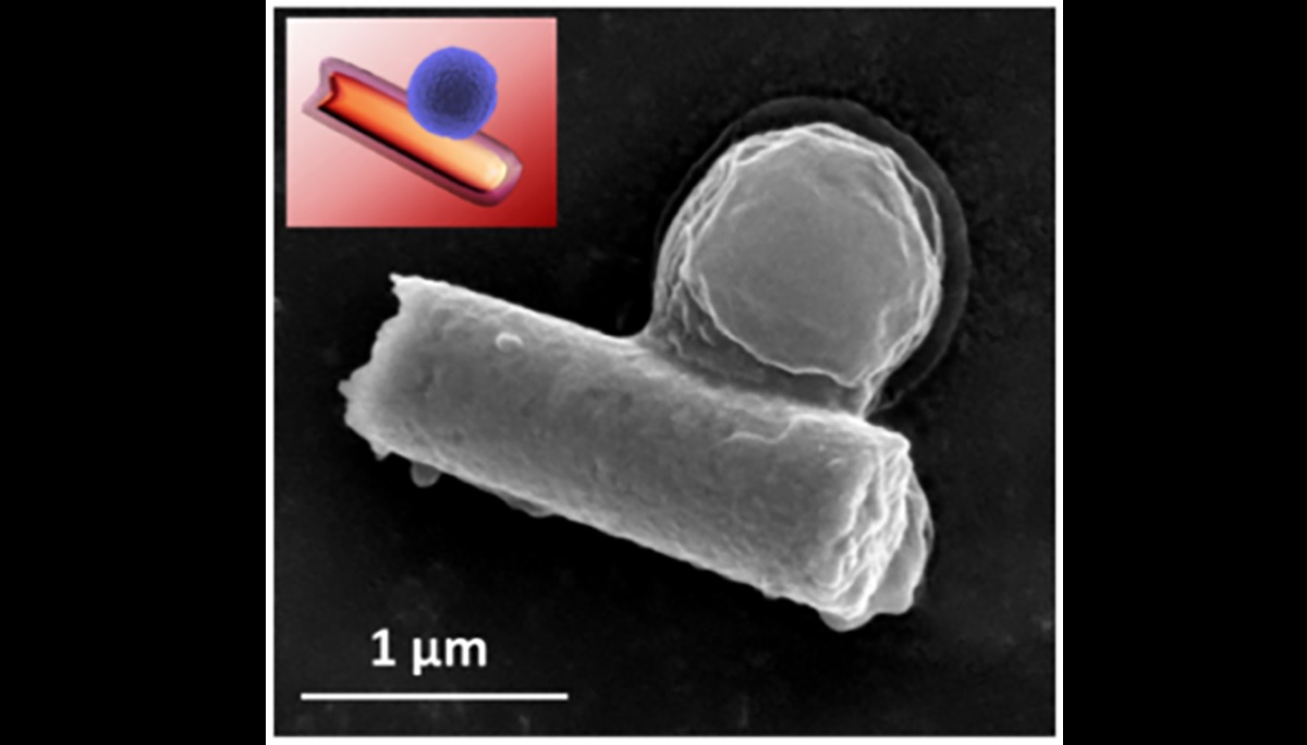 MRSA bacterium (sphere) attached to the biohybrid nanorobot. (Berta Esteban-Fernández de Ávila et al., Science Robotics. 3, 2018)